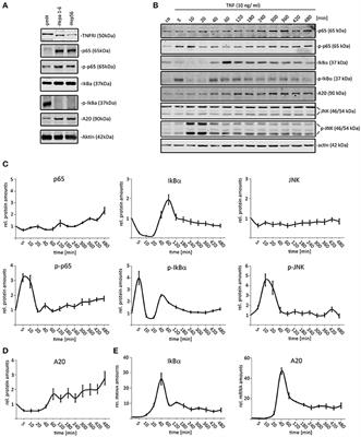 A20/TNFAIP3 Discriminates Tumor Necrosis Factor (TNF)-Induced NF-κB from JNK Pathway Activation in Hepatocytes